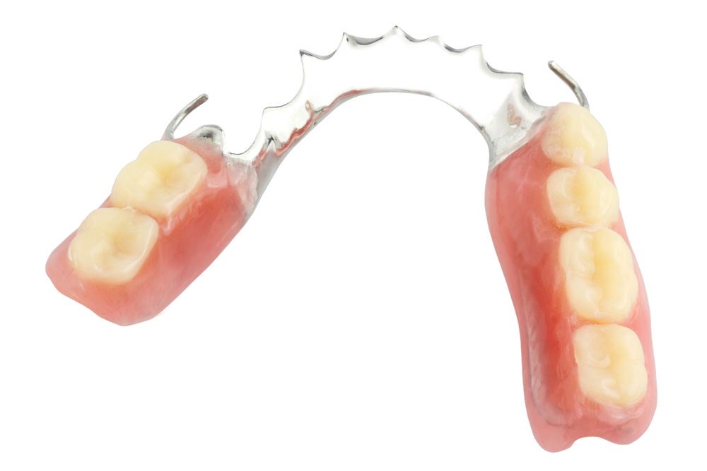 Partial denture