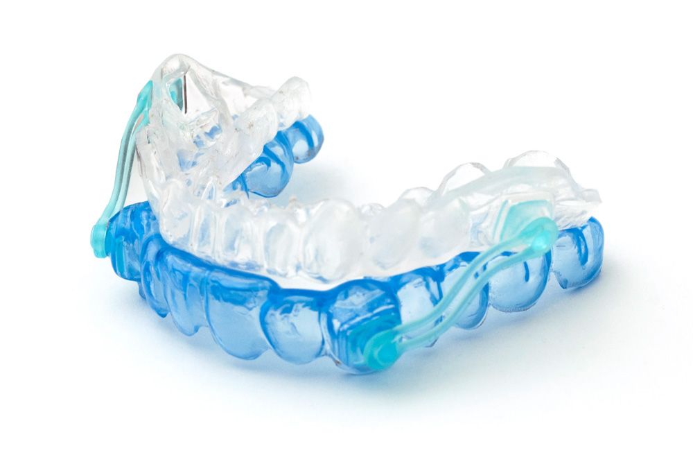 Photo of an oral appliance used for TMJ